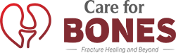 careforbones